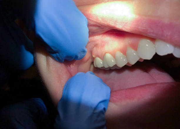 Best Emergency Dental Care for Sports Injuries in Waynesboro, GA